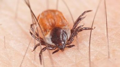 tick attached to human skin