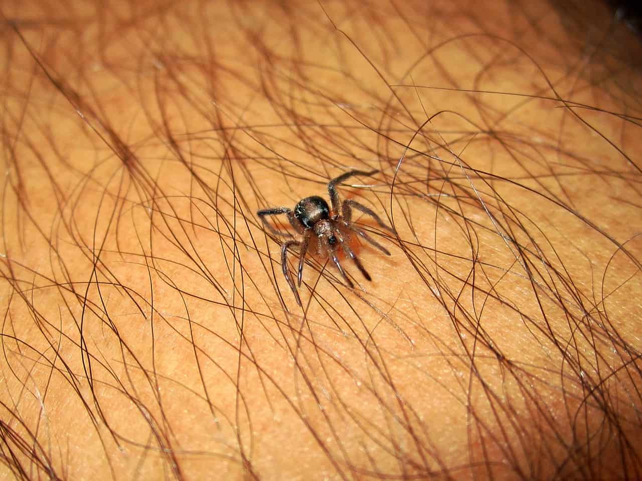spider bite treatment